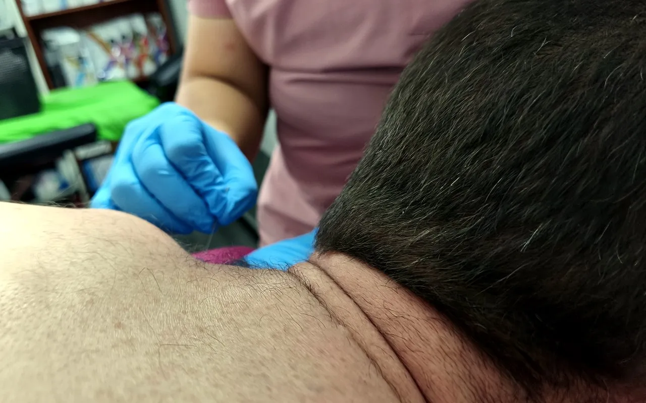 Terapia invasiva